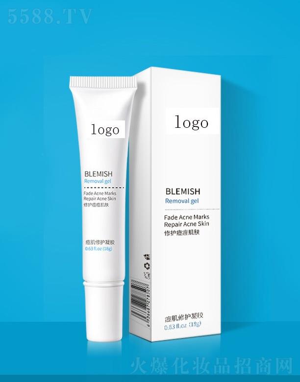 IRY�������o(h��)���z