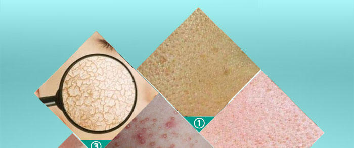 ��ˬƽ��PH�{(di��o)��¶