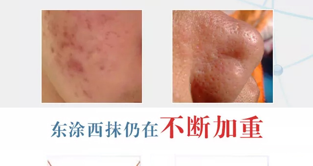 �wʿ�_�����r�������o���ɷ�+�����r�������o��øҺ