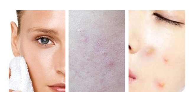 Ԋ��������r(sh��)����͸������(y��n)�y��ĭ