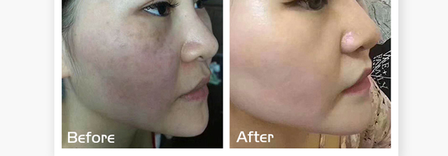 ΢�ķ����o(h��)ԭҺ