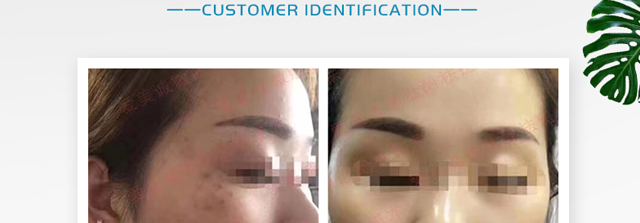 ΢�ķ����o(h��)ԭҺ