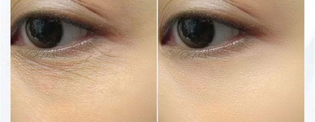 ���������o˪