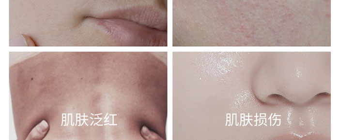 ���㷼����̥���F�D��