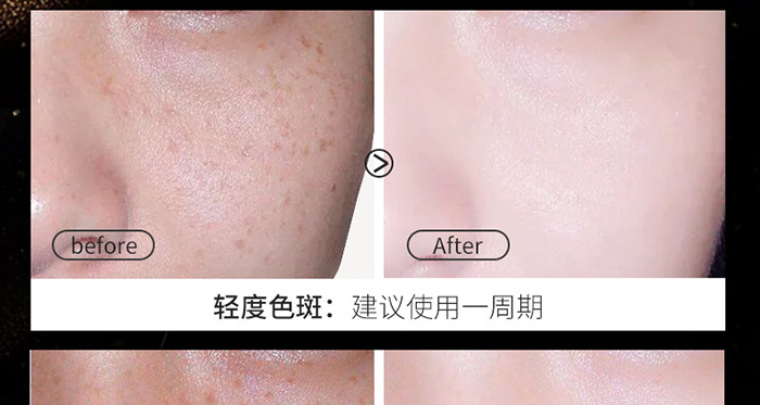 ϧ��܎����݌���