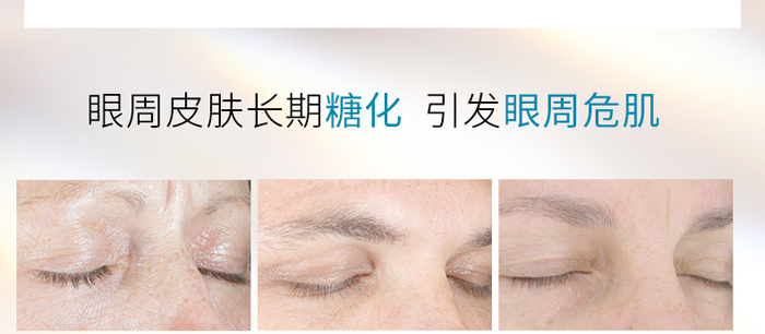 ��������˪