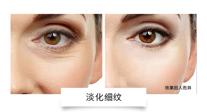 �C��ѩ�w��ĸ���Ŀ���ˮ