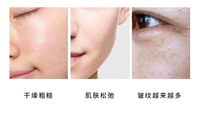 ���������߽M����ԭ�ޏ�(f��)���_Һ_05